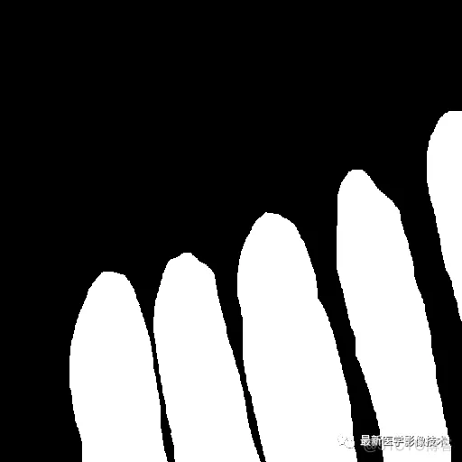 Tensorflow入门教程（十三）——医学图像分割案例_深度学习_07